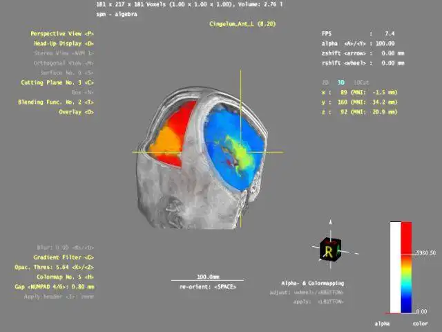 Download web tool or web app 3DBrainExplorer to run in Windows online over Linux online