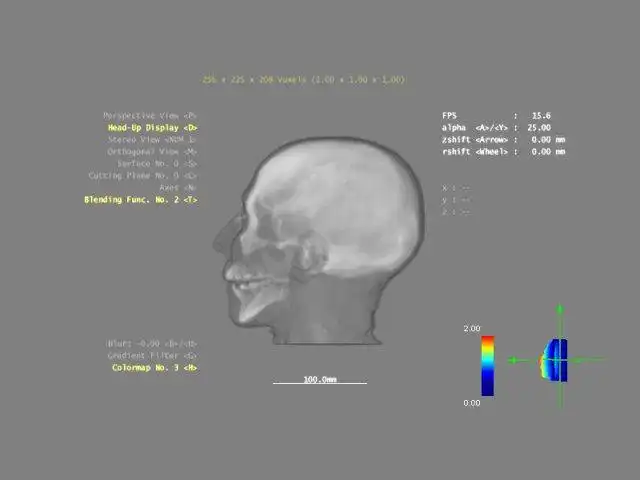 Download web tool or web app 3DBrainExplorer to run in Windows online over Linux online