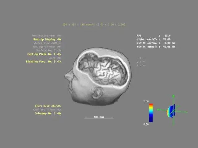 Download web tool or web app 3DBrainExplorer to run in Windows online over Linux online