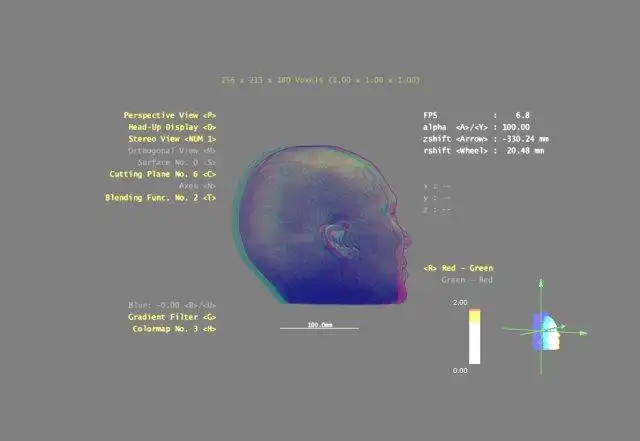 Download web tool or web app 3DBrainExplorer to run in Windows online over Linux online