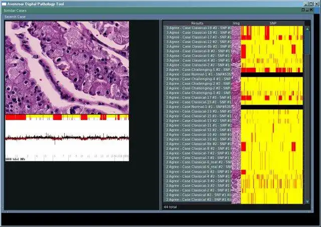 Download web tool or web app Avenzoar Digital Pathology Tool to run in Linux online