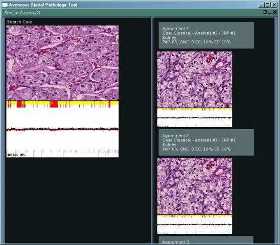 Download web tool or web app Avenzoar Digital Pathology Tool to run in Linux online