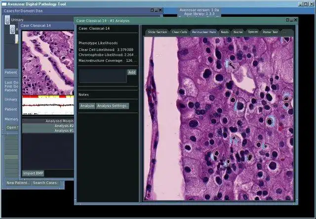 Download web tool or web app Avenzoar Digital Pathology Tool to run in Linux online