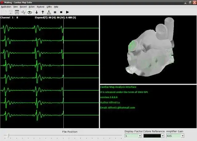 Download web tool or web app CardiacMap