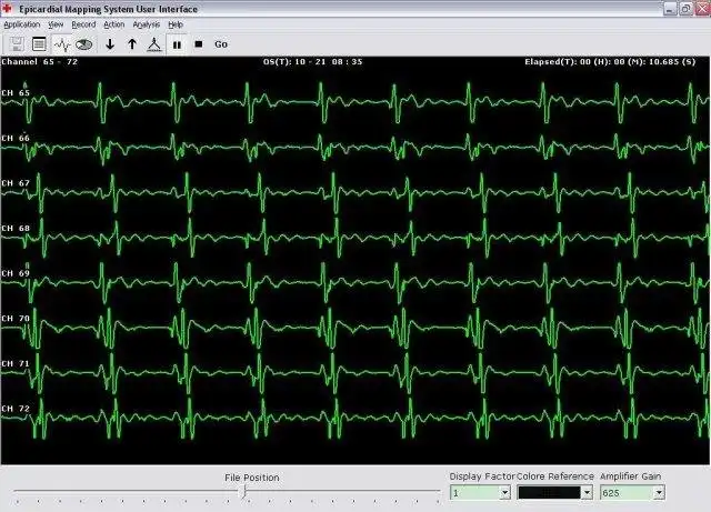 Download web tool or web app CardiacMap