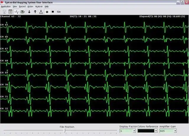 Download web tool or web app CardiacMap to run in Windows online over Linux online