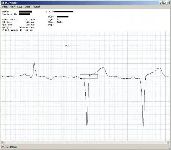 Download web tool or web app C# ECG Toolkit to run in Linux online