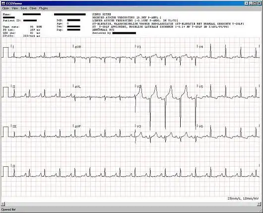 Download web tool or web app C# ECG Toolkit to run in Linux online