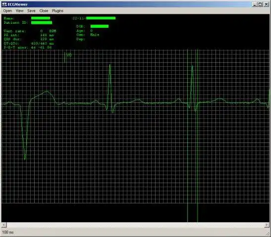 Download web tool or web app C# ECG Toolkit to run in Linux online