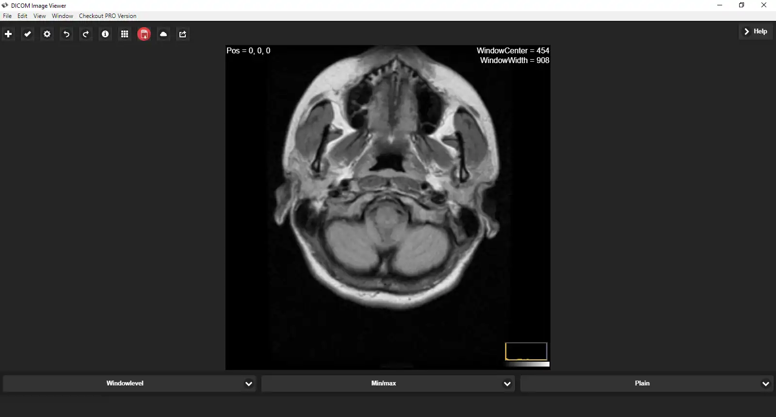 Download web tool or web app DICOM Image Reader