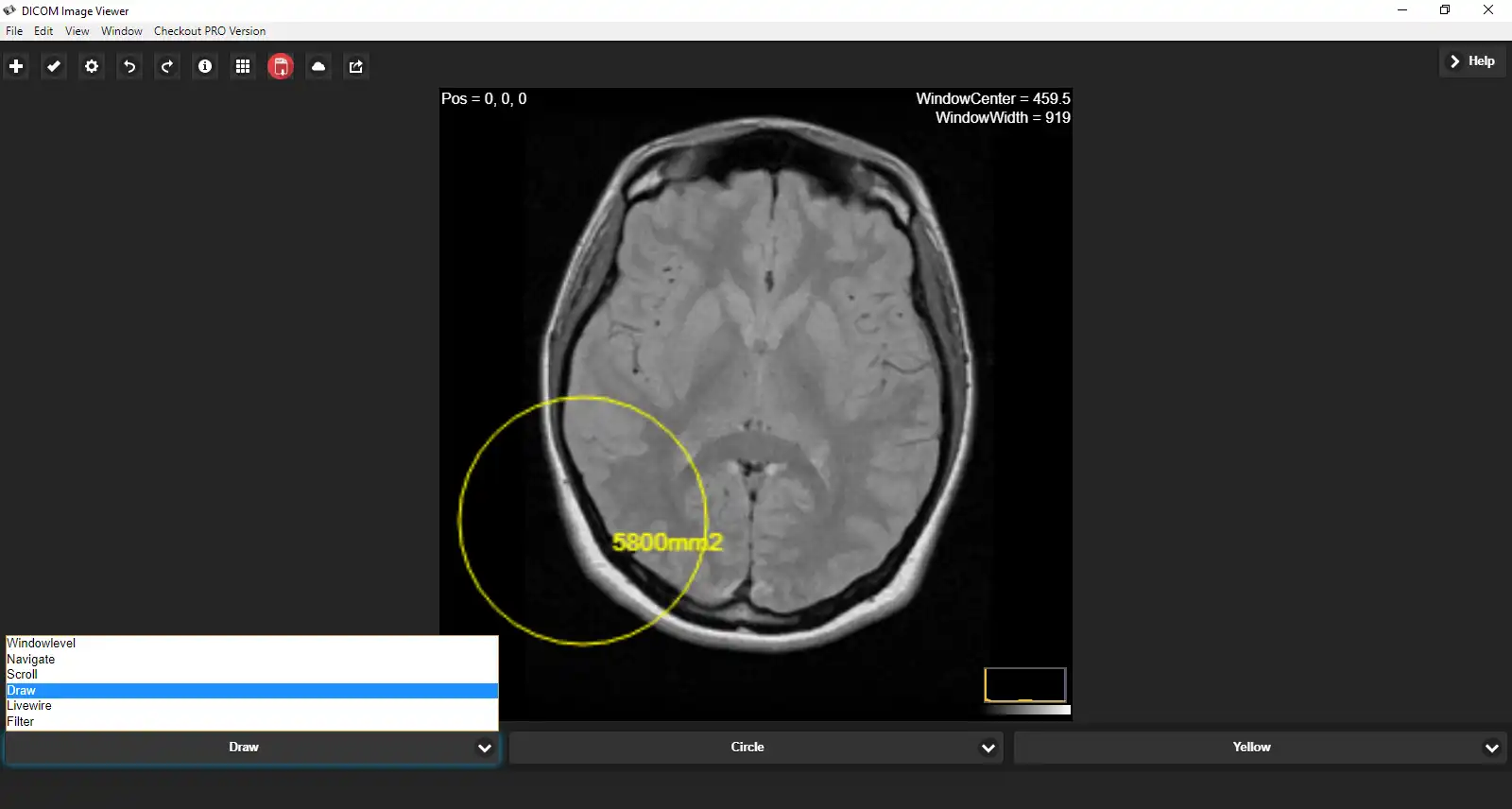 Download web tool or web app DICOM Image Reader