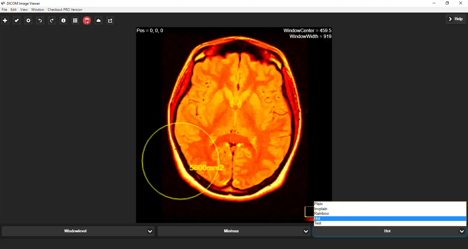 Download web tool or web app DICOM Image Reader