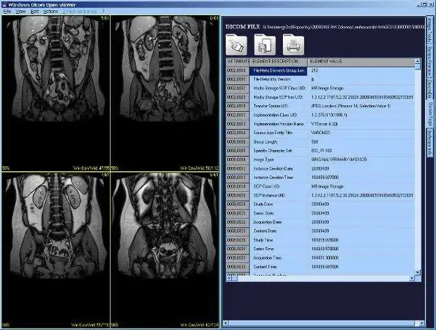 Download web tool or web app Dicom Widow to run in Windows online over Linux online