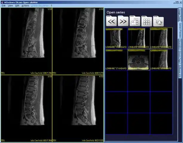 Download web tool or web app Dicom Widow to run in Windows online over Linux online