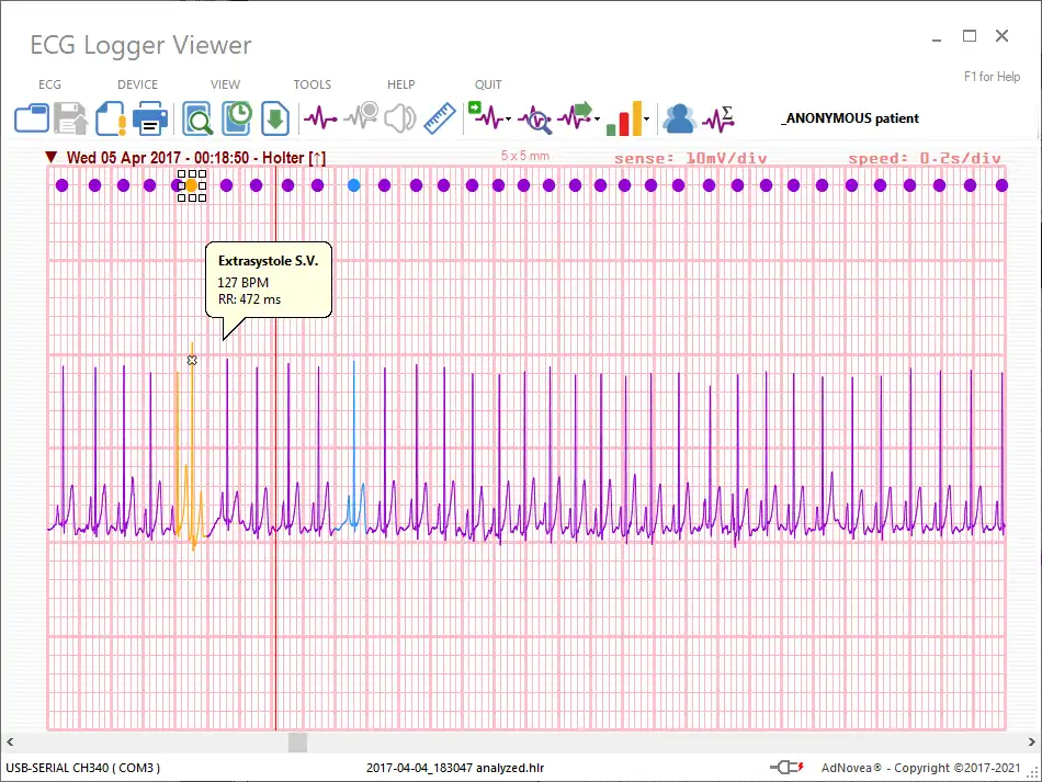 Download web tool or web app ECG Logger Viewer