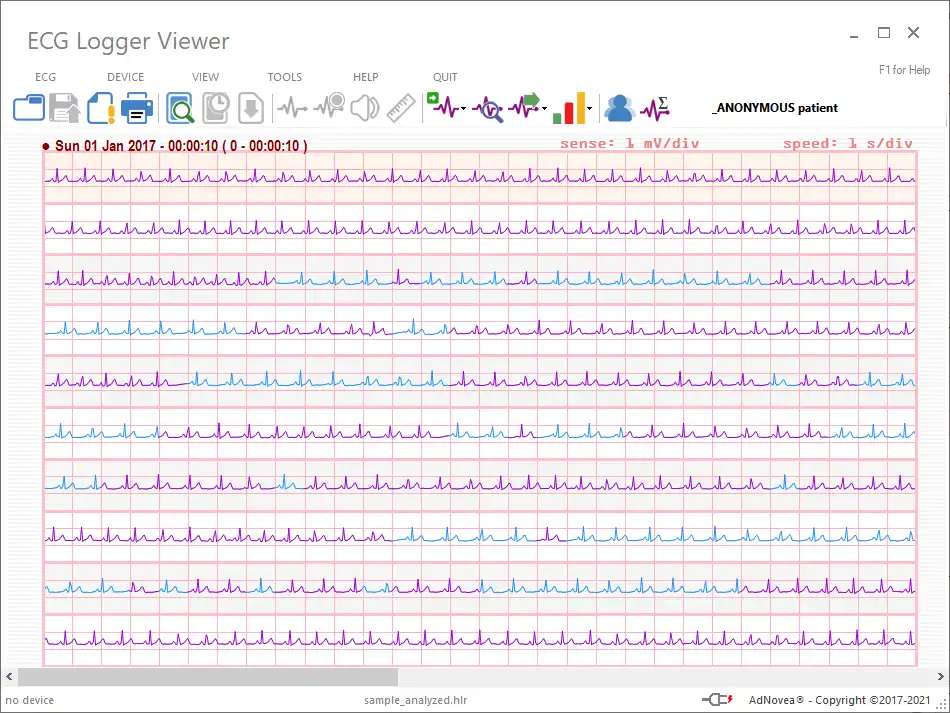 Download web tool or web app ECG Logger Viewer