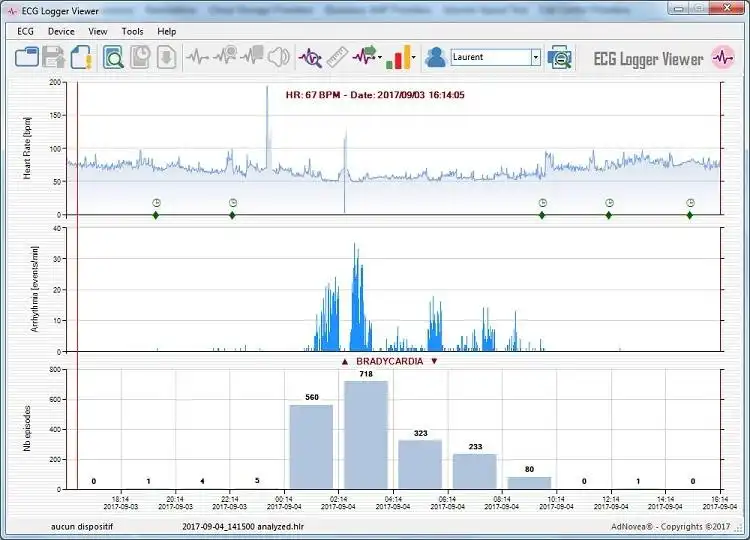 Download web tool or web app ECG Logger Viewer