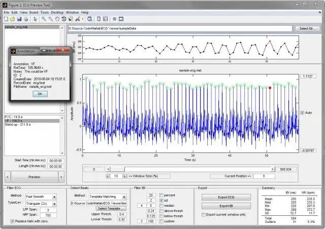 下载网络工具或网络应用程序 ECG 查看器