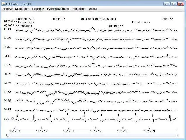 Download web tool or web app EEG-Holter to run in Windows online over Linux online