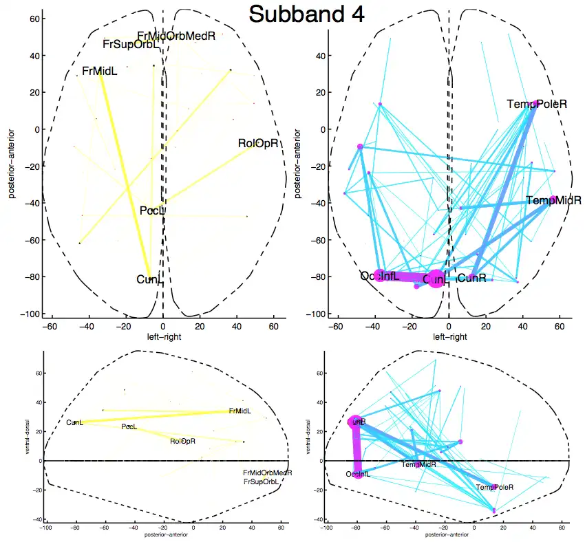 Download web tool or web app Flexible Brain Graph Visualizer