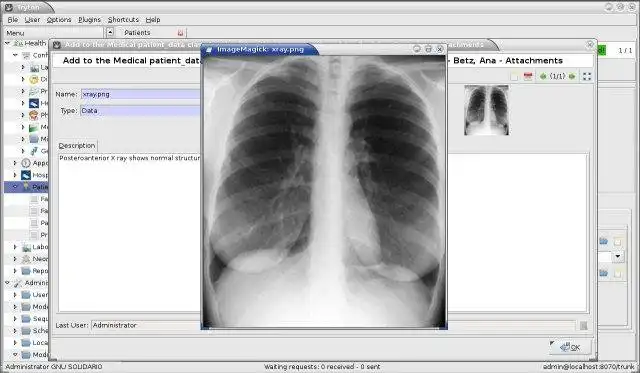 Download web tool or web app GNU Health to run in Linux online