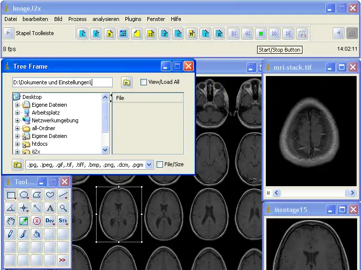 Download webtool of webapp ImageJ2x