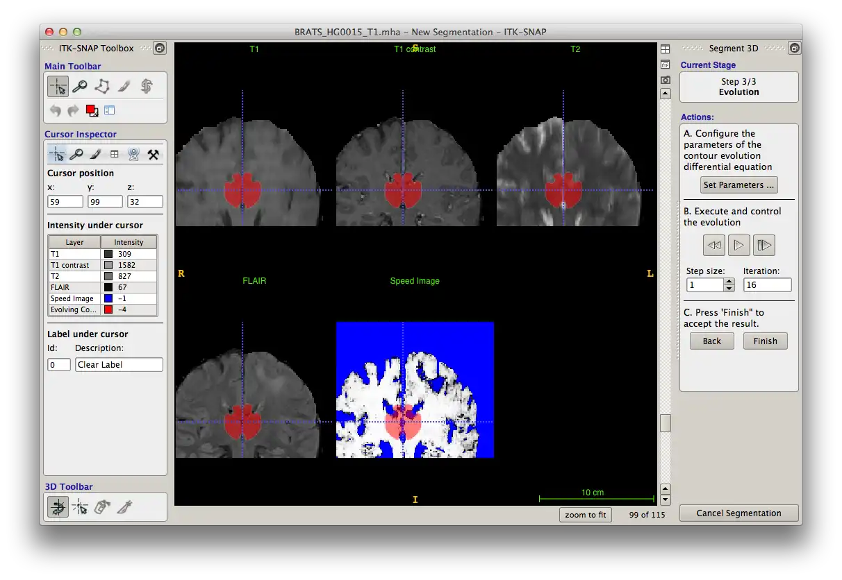 Download web tool or web app ITK-SNAP Medical Image Segmentation Tool