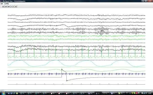 Download web tool or web app jBioSignal