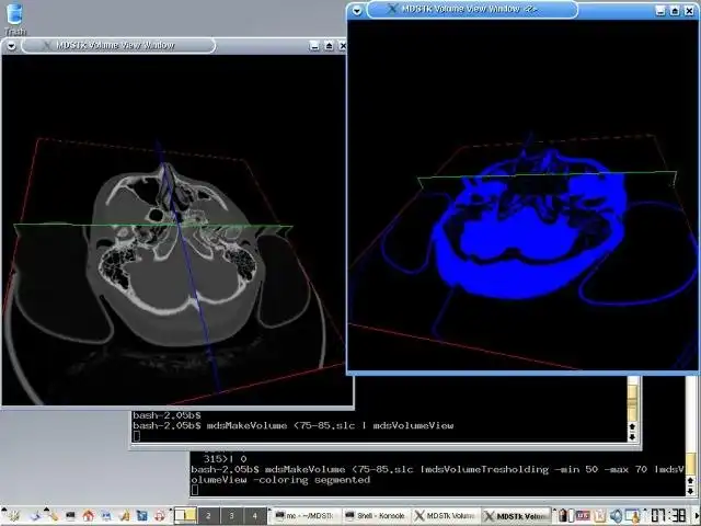 Download web tool or web app Medical Data Segmentation Toolkit