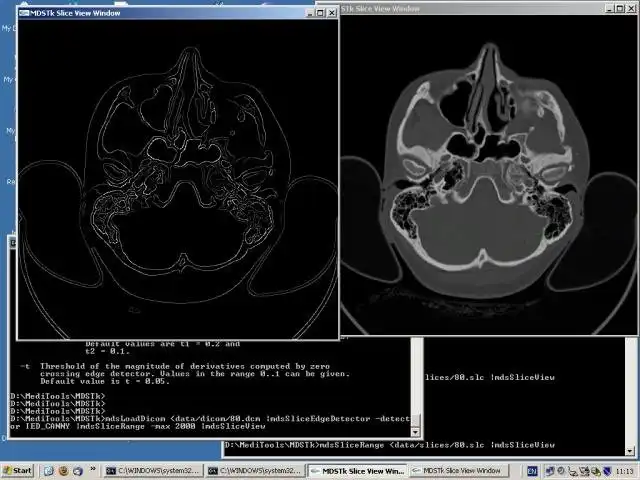 Download web tool or web app Medical Data Segmentation Toolkit to run in Linux online