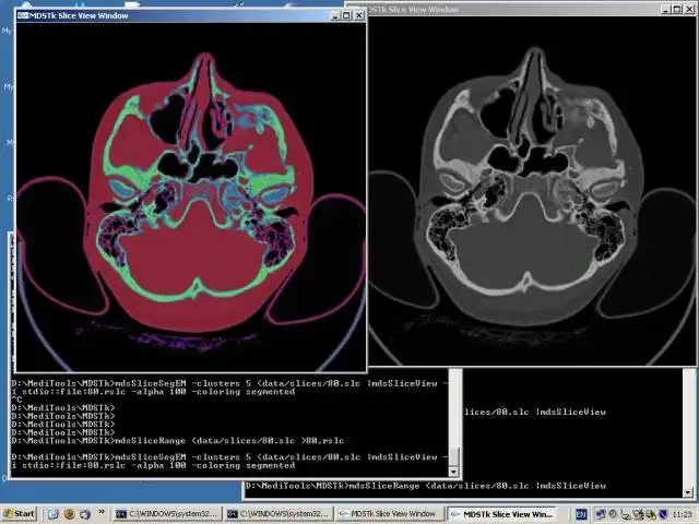 Download web tool or web app Medical Data Segmentation Toolkit to run in Windows online over Linux online