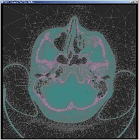 Download web tool or web app Medical Data Segmentation Toolkit to run in Windows online over Linux online