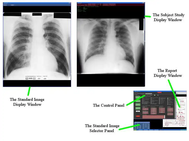 Descargue la herramienta web o la aplicación web NIOSH_BViewer para ejecutar Windows en línea sobre Linux en línea