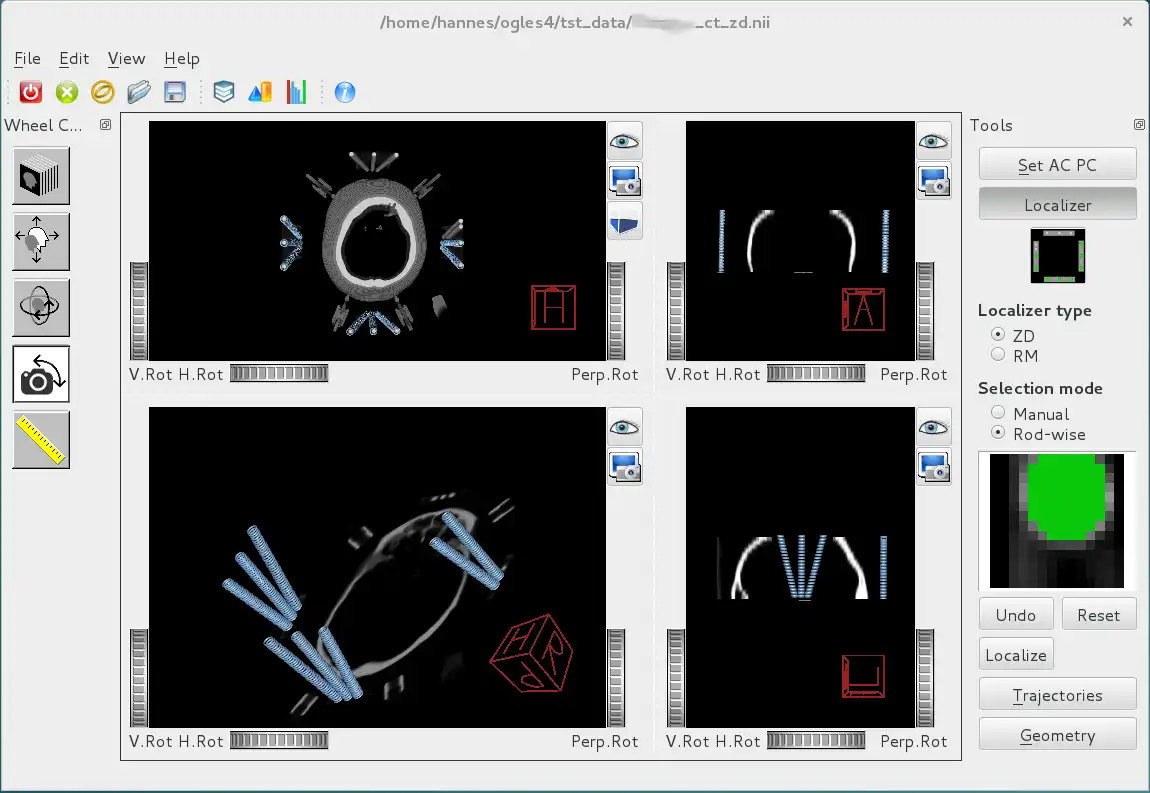 Download web tool or web app Ogles -  OpenGL/OIV  stereotactic tool to run in Windows online over Linux online