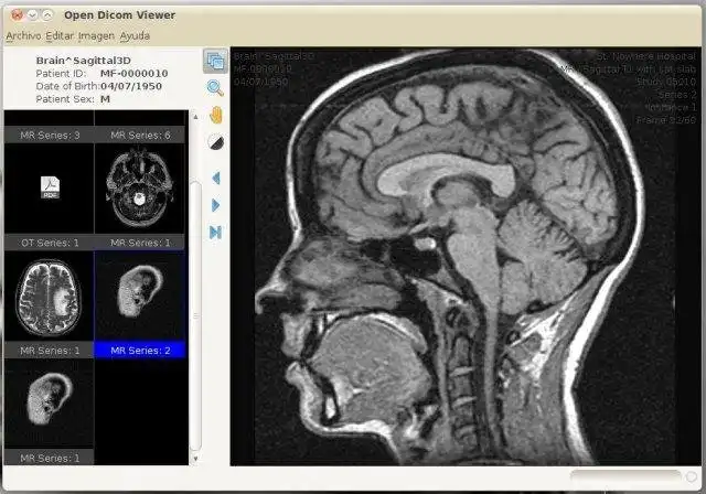 Download webtool of webapp Open Dicom Viewer