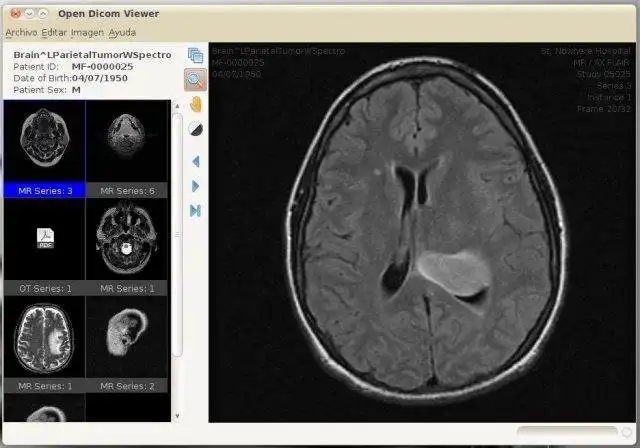 Download web tool or web app Open Dicom Viewer