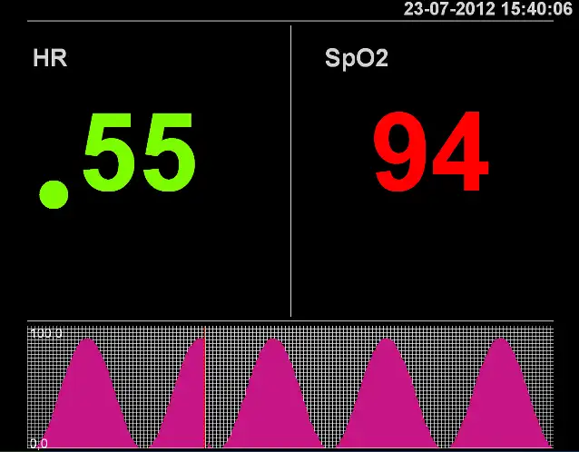 Download web tool or web app Patient Monitor to run in Linux online