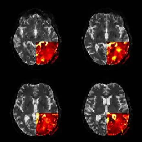 Download web tool or web app R Package for the Analysis of DCE-MRI