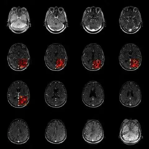 Download web tool or web app R Package for the Analysis of DCE-MRI to run in Windows online over Linux online