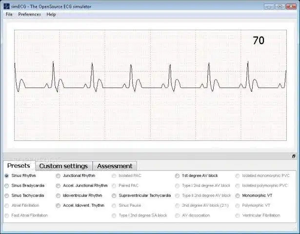 Download web tool or web app simECG