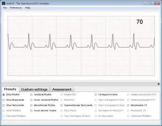 Download web tool or web app simECG to run in Linux online